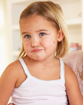 Food Allergies in Children